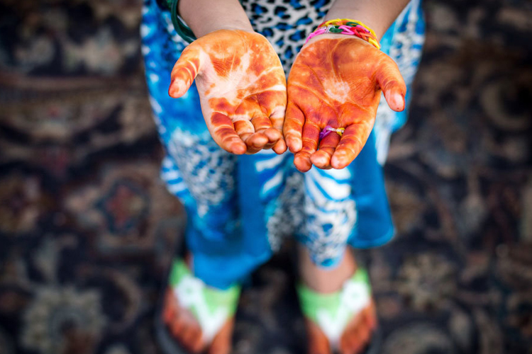 تصویر تصویر