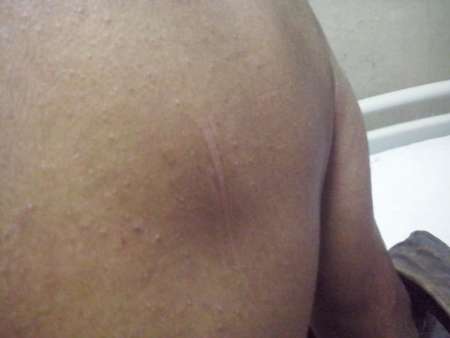 حمله با چاقو دستمزد خدمت محیط بان +(تصاویر) حمله با چاقو دستمزد خدمت محیط بان +(تصاویر)