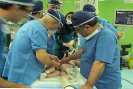 (تصاویر) جداسازی دوقلوی بههم چسبیده (تصاویر) جداسازی دوقلوی بههم چسبیده