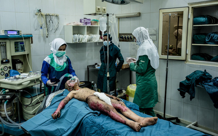 (تصاویر) مرگ پیش از پروانگی