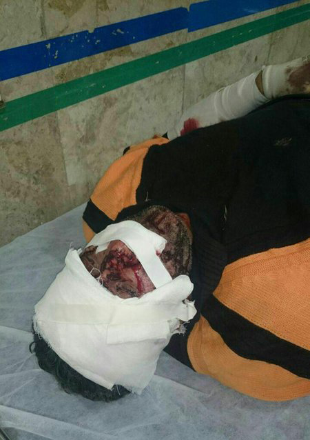 نجات چوپان از چنگال پلنگ در سوادکوه نجات چوپان از چنگال پلنگ در سوادکوه