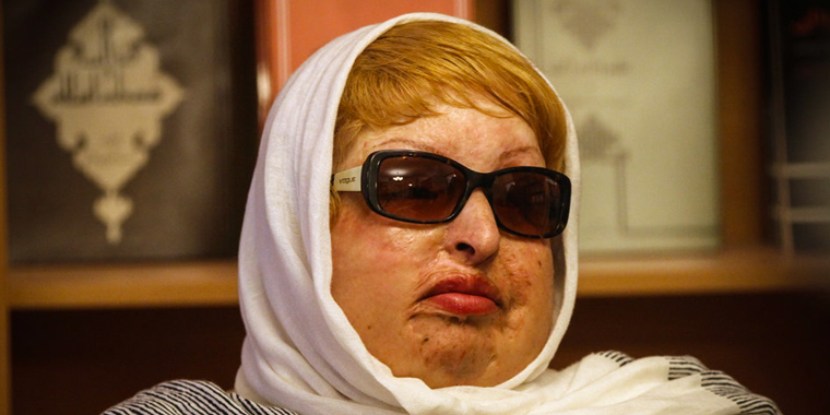 عکس عکس