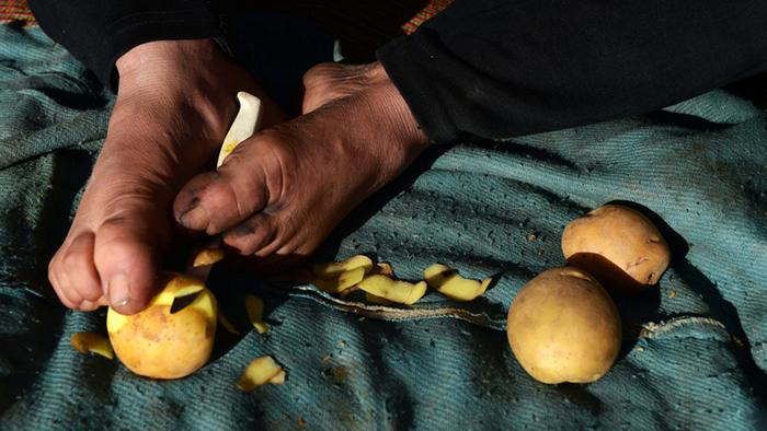 (تصاویر) زندگی زن افغان بدون دست