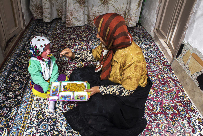 (تصاویر) بیماری پوستیِ نرگس (تصاویر) بیماری پوستیِ نرگس