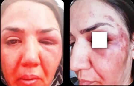 حمله وحشیانه