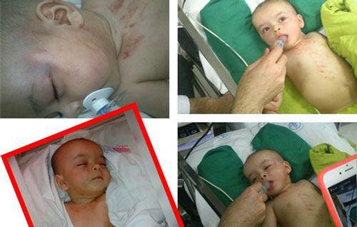 جزییات تازه از شکنجه یک نوزاد در رشت جزییات تازه از شکنجه یک نوزاد در رشت