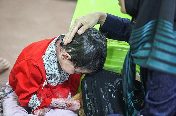 (تصاویر) این کودکان با چرک و زخم زندگی میکنند (تصاویر) این کودکان با چرک و زخم زندگی میکنند