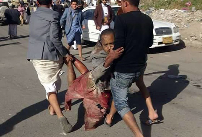 (تصاویر) حمله عربستان به مراسم عزا در یمن (تصاویر) حمله عربستان به مراسم عزا در یمن