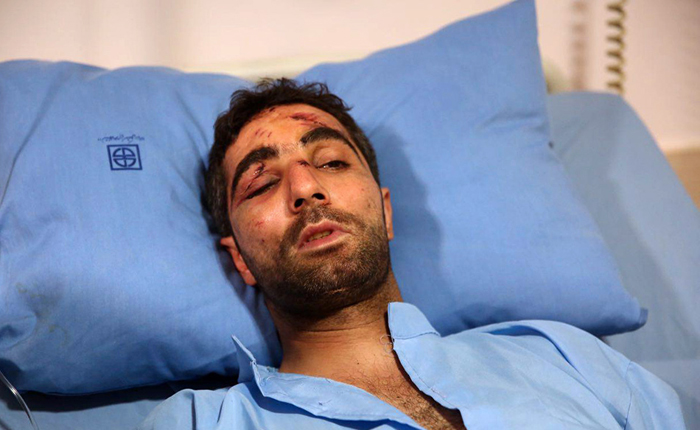 (تصاویر) مجروحان حادثه قطار سمنان (تصاویر) مجروحان حادثه قطار سمنان