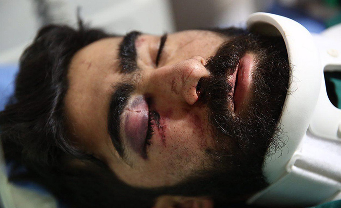 (تصاویر) مجروحان حادثه قطار سمنان (تصاویر) مجروحان حادثه قطار سمنان