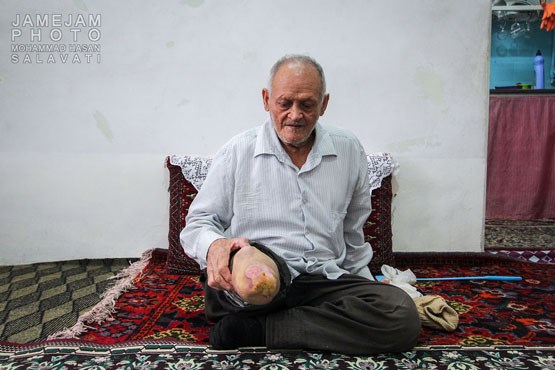 ناگفته‌هایی درباره ساکنان شهرک جذامی‌ها