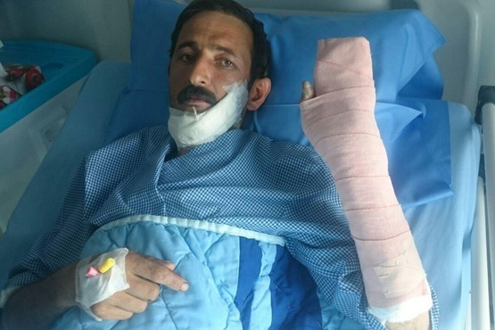 (عکس) فک، زبان و دست قطع شده مصدوم ۳۹ ساله پیوند خورد!