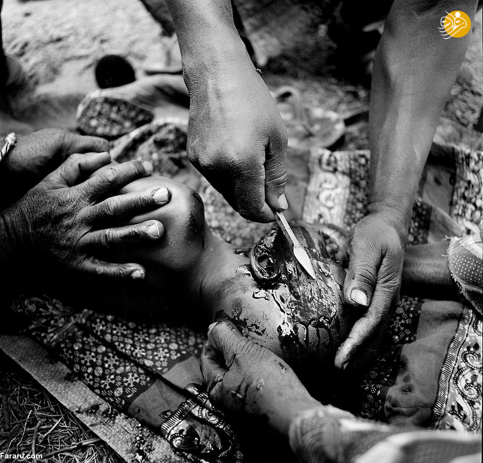 (تصاویر) رسم دلخراش زخم‌آرایی