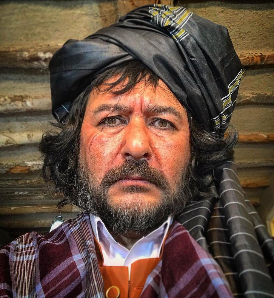 (تصویر) صورت زخمی امیرحسین صدیق در یک فیلم