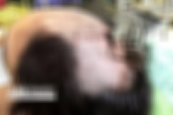 کودک آزاری در قزوین؛ فرو بردن کلید منزل در سر کودک توسط مادر! کودک آزاری در قزوین؛ فرو بردن کلید منزل در سر کودک توسط مادر!