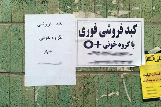 جنجال اهدای عضو محکومان به اعدام؛ چند استدلال و یک پرسش