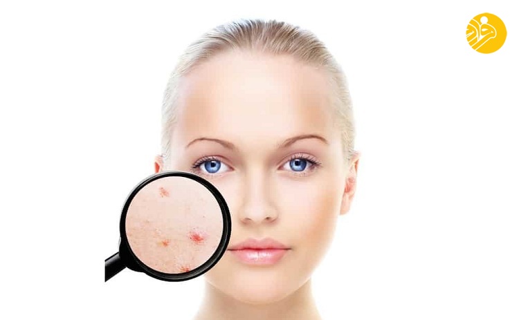 ۱۵ مزیت لیمو ترش ۱۵ مزیت لیمو ترش