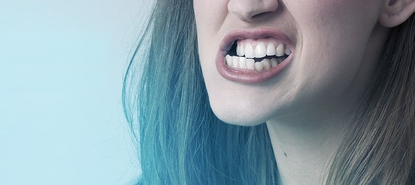 دندان قروچه چیست؟ علت ایجاد و بهترین درمان های خانگی برای آن کدام است؟