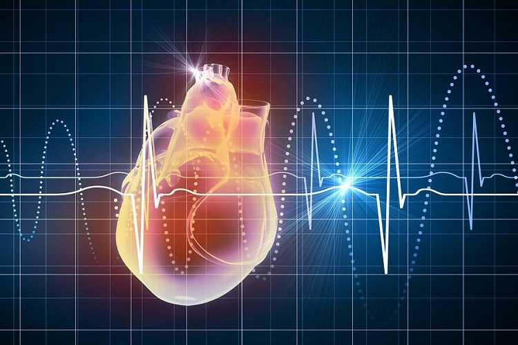 تپش قلب چیست؟ تپش قلب؛ نشانه ها، علل و راههای درمان آن