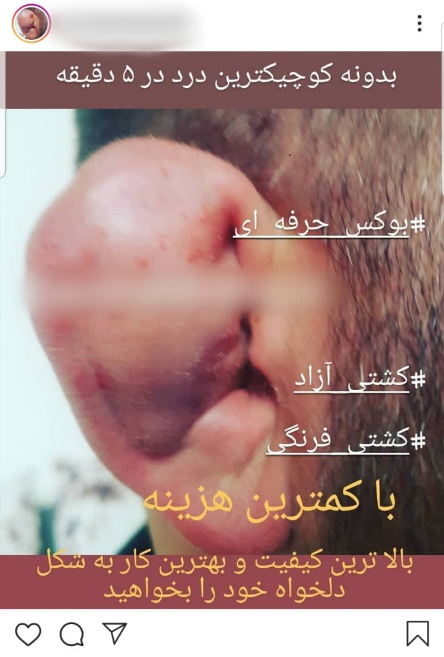 تبلیغات عجیب؛ بدون خط و خش، تنها با ۲۵۰هزارتومان کشتی‌گیر شوید!