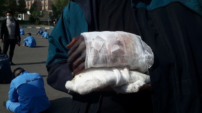 (ویدئو) تصاویر تکان دهنده از قطع دست کشتی گیر تیم ملی با شمشیر؛ متهم: خودشان دست خودشان را قطع کردند!