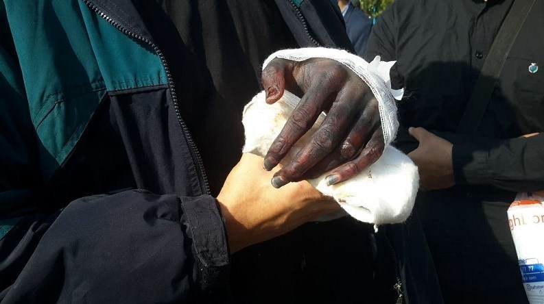 (ویدئو) تصاویر تکان دهنده از قطع دست کشتی گیر تیم ملی با شمشیر؛ متهم: خودشان دست خودشان را قطع کردند!