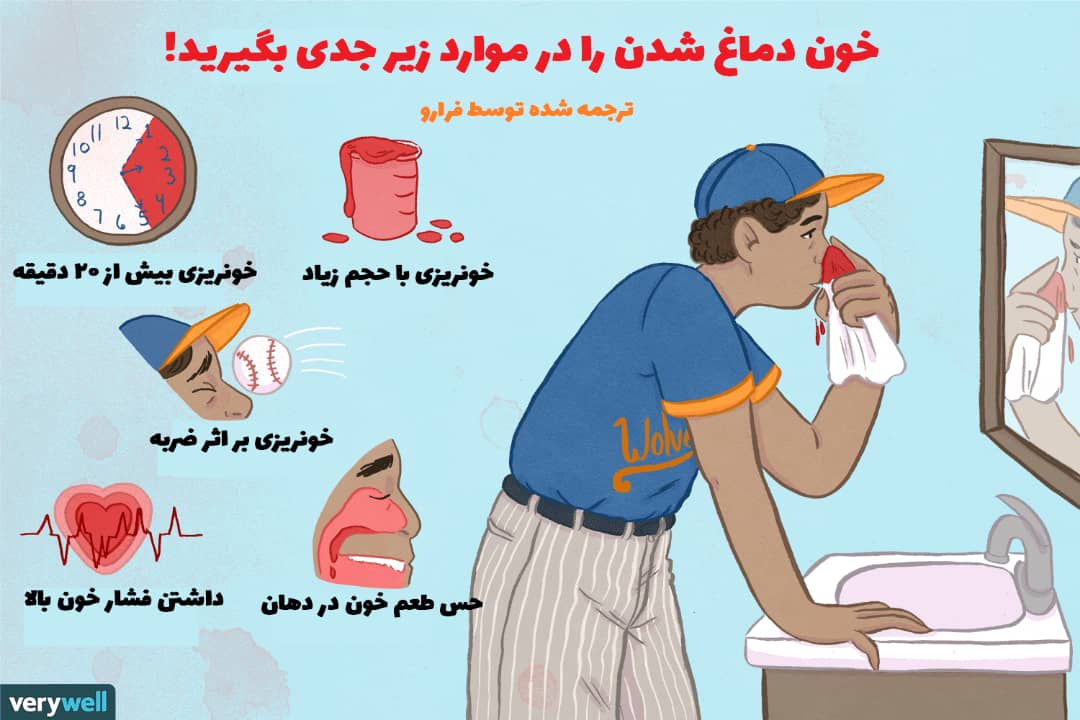 دلایل خون دماغ