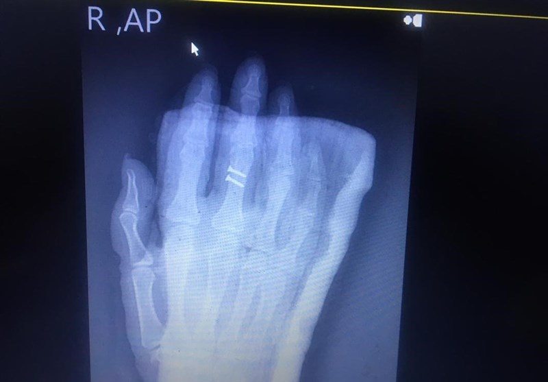 ضرب و شتم خبرنگار خانم توسط حراست دانشگاه