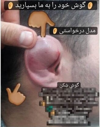 آگهی شکستن گوش