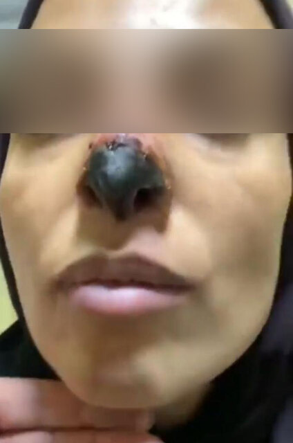 جراحی
