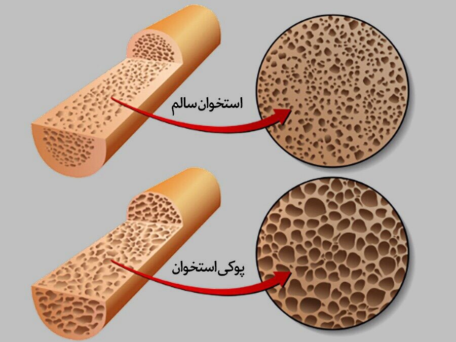 پوکی