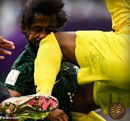 (عکس) جمجمه شهرانی خرد شد!