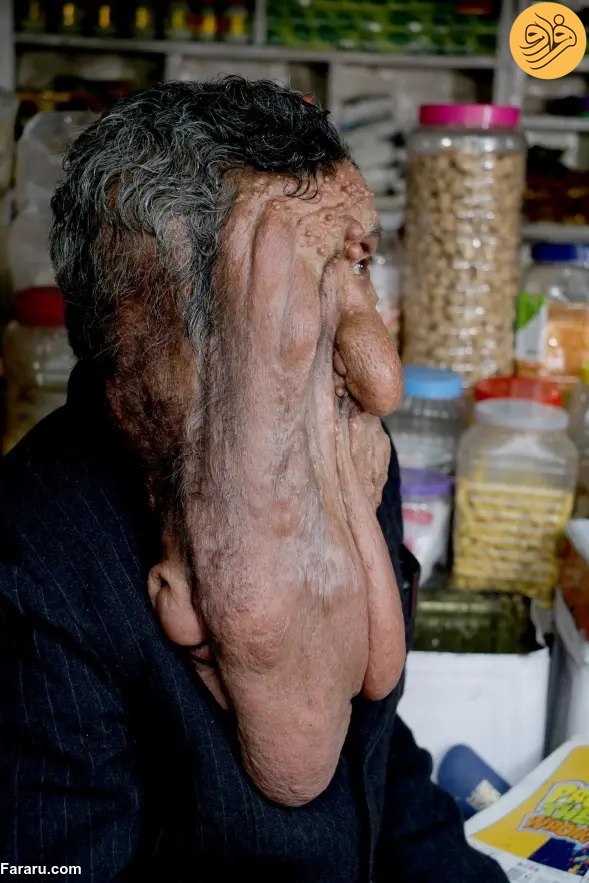 (ویدئو)