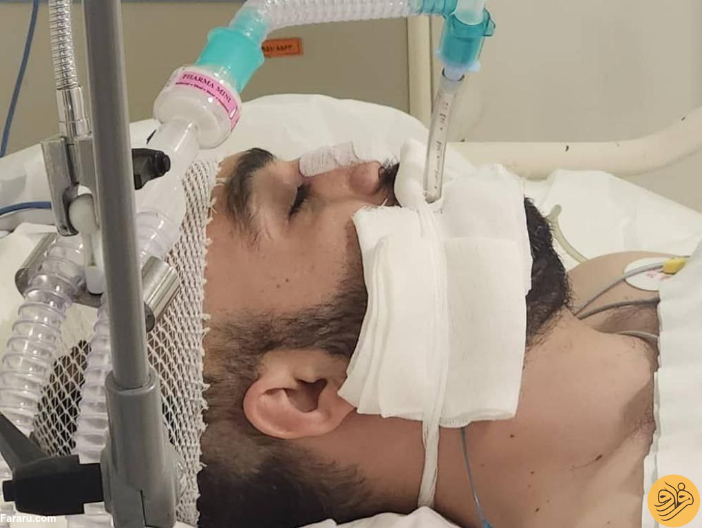 (عکس) اتفاق تلخ برای فوتبالیست ایرانی