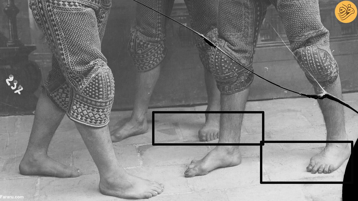 راز یک تصویر قدیمی؛ روزهایی که «مرض سالک» نشانه تهرانی بودن، بود!