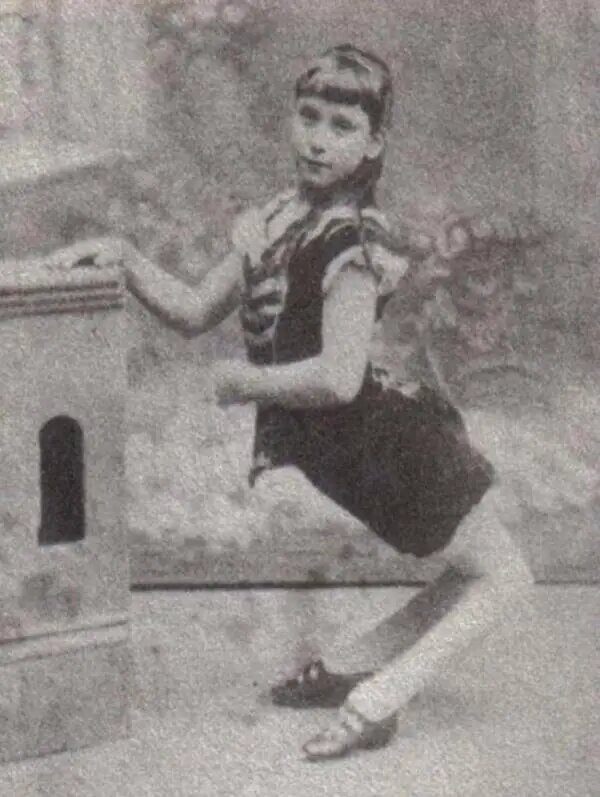 (عکس) راز «دختر شتری» که دنیا را در بهت فرو برد!