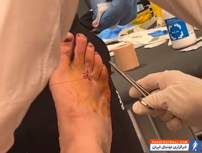 (عکس) بنزما با پای زخمی ۹۰ دقیقه بازی کرد