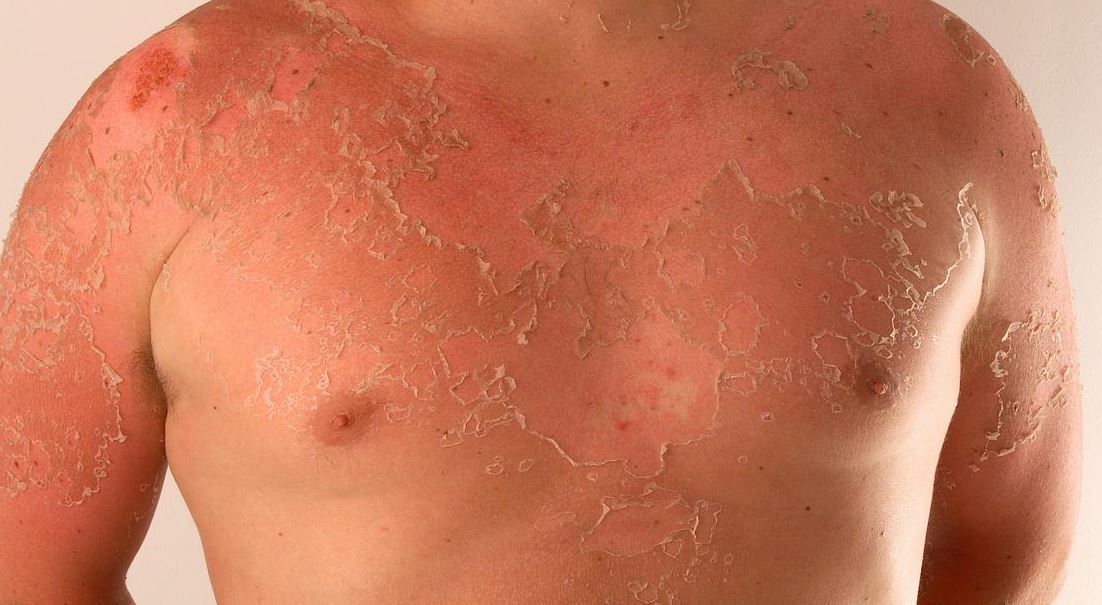 بررسی واقعیتِ ۴ ادعا در مورد کرم ضد آفتاب/ خوانده شد