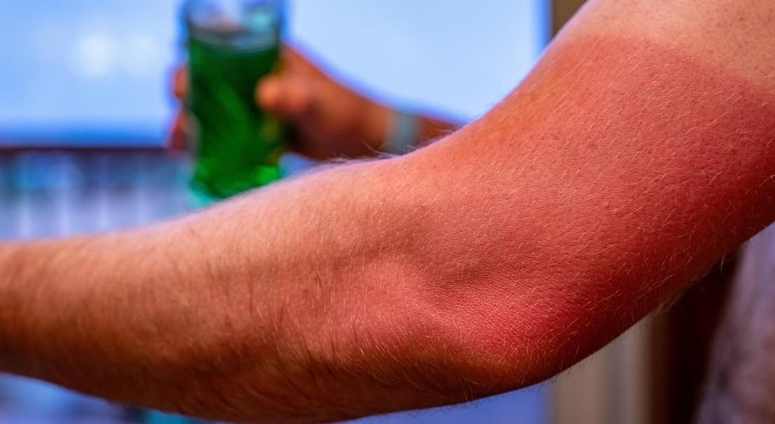 بررسی واقعیتِ ۴ ادعا در مورد کرم ضد آفتاب/ خوانده شد