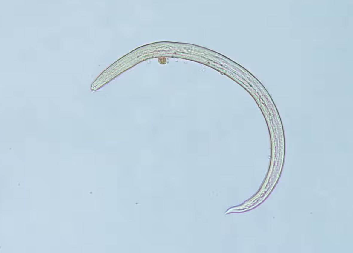 از کرم ریه تا سوسک سیگار، این موجودات در شما لانه سازی می‌کنند؟