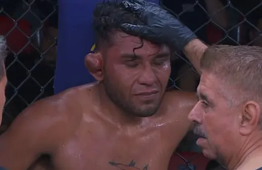 ترکیدن گوش مبارز MMA در اثر ضربه مشت حریف که به مبارزه پایان داد