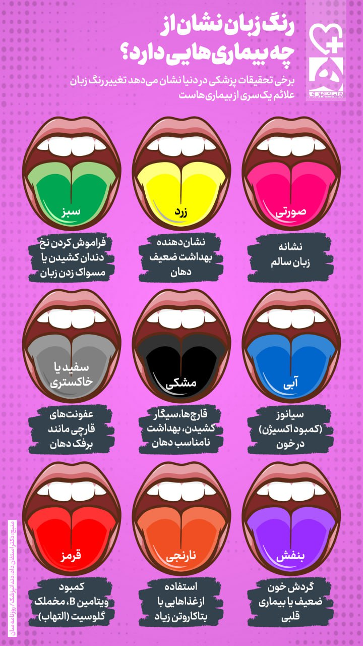 رنگ زبان شما درباره سلامتی‌تان چه می‌گوید؟ (اینفوگرافیک)