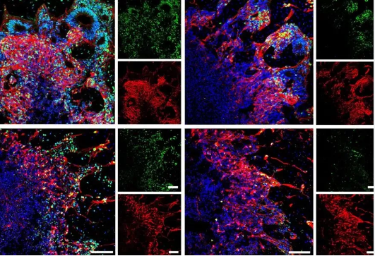 دانشمندان چینی بافت مغز منجمدشده انسان را پس از ۱۸ ماه احیا کردند