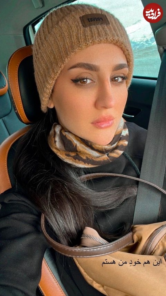 تغییر چهره چشم نواز «گلنار» ۳ سال بعد سریال گیلدخت در ۳۳ سالگی (تصاویر)